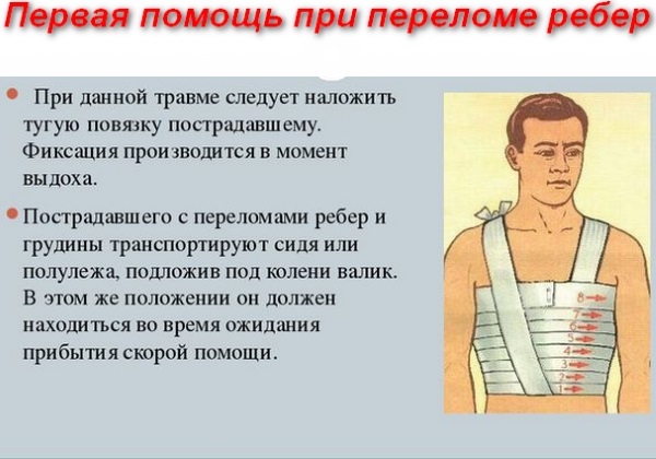 Перелом ребра. Симптомы, первая помощь, бандаж, лечение в домашних условиях, сколько заживает, осложнения