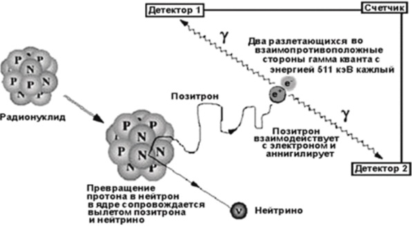 ПЭТ КТ. Что это за исследование, отзывы пациентов, цена