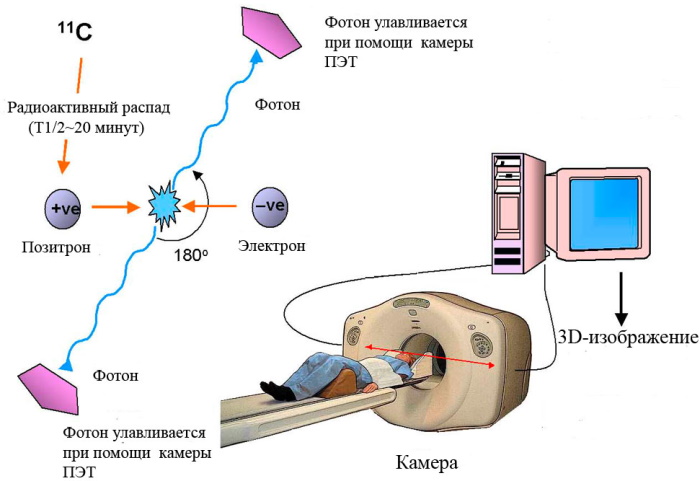 ПЭТ КТ. Что это за исследование, отзывы пациентов, цена