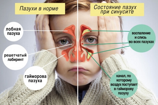 Поднимается температура после еды у взрослого, ребенка