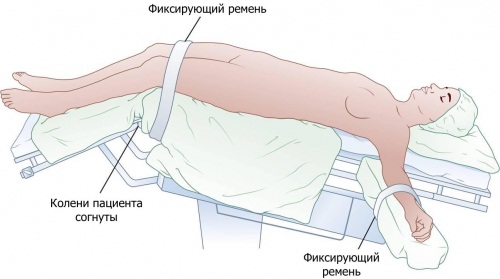 Положение Тренделенбурга. Что это такое, как применяется при операциях, рентгене, анафилактическом шоке