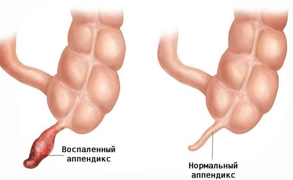 Постоянно тошнит. Причины у женщины, если не беременность. Что делать