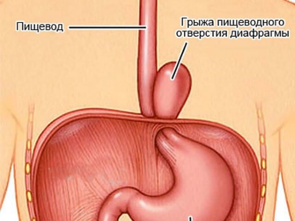 Постоянно тошнит. Причины у женщины, если не беременность. Что делать