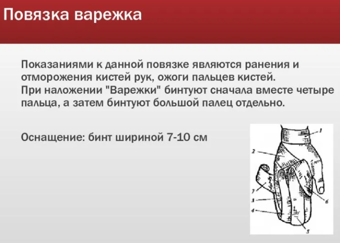 Повязка варежка на кисть. Алгоритм, техника наложения, показания