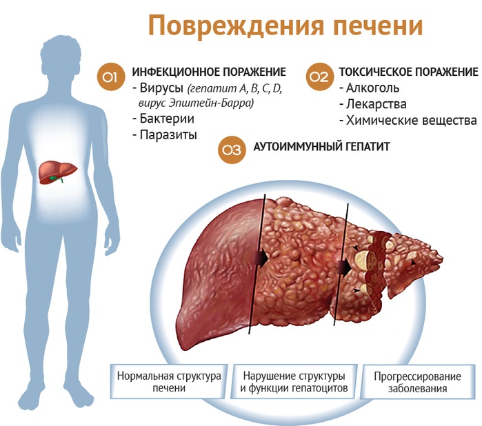Признаки больной печени у женщины на коже, лице, симптомы, лечение