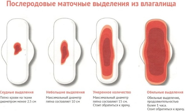 Признаки кровотечения у женщин в матке после родов, кесарева, месячных, при беременности. Причины
