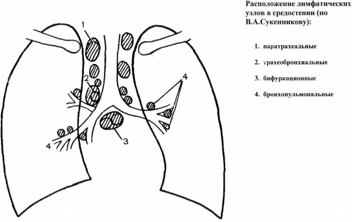 Лимфоузлы на теле человека. Схема расположения у женщин, мужчин, фото