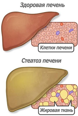 Раствор глюкозы 5-процентный. Инструкция по применению, цена