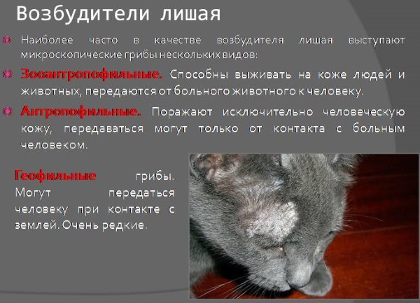 Разновидности лишая у человека. Фото, описание, симптомы и лечение