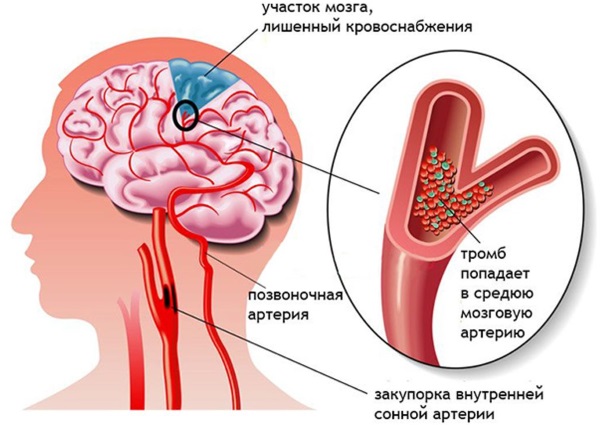 Розувастатин. Инструкция по применению. Цена, аналоги