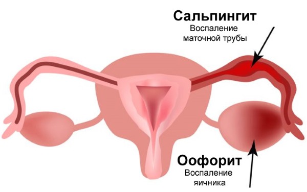 Повышен ФСГ в фолликулярной фазе. Что это значит, причины и лечение, что делать