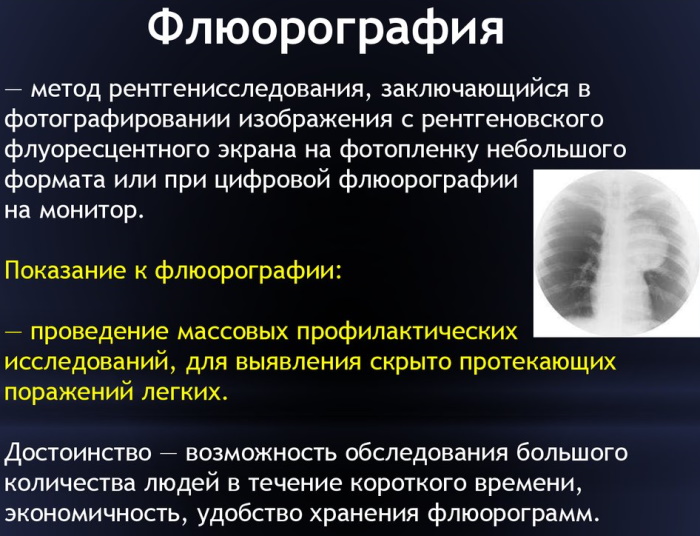 Сделать флюорографию бесплатно по полису ОМС