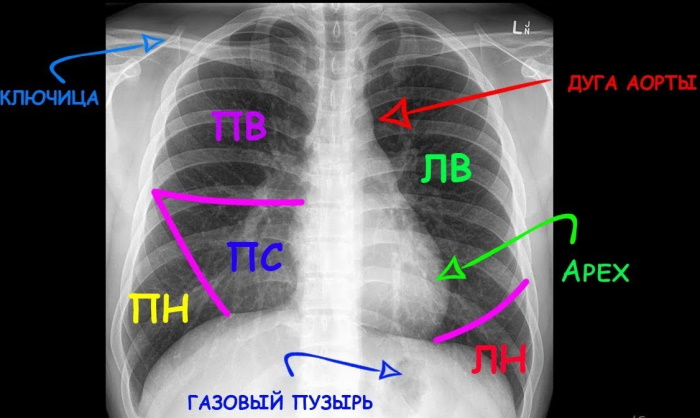 Сделать флюорографию бесплатно по полису ОМС