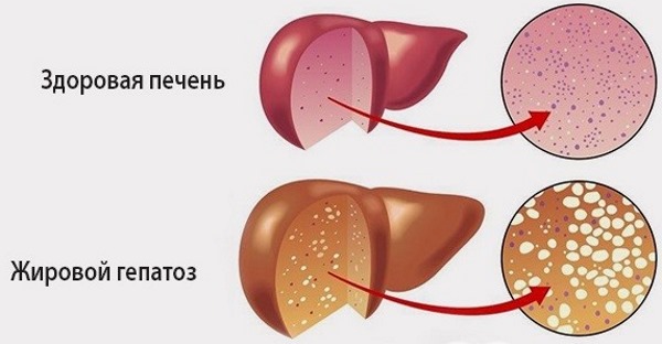 Шрот расторопши. Инструкция по применению для похудения, печени, от кашля, для детей. Полезные свойства и противопоказания, как принимать