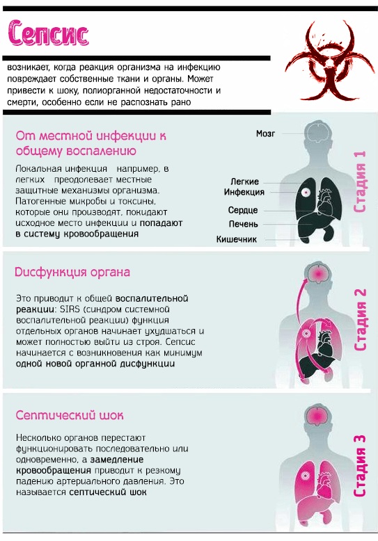 Капиллярное кровотечение. Как остановить: способы, алгоритм, первая помощь. Отличия от венозного