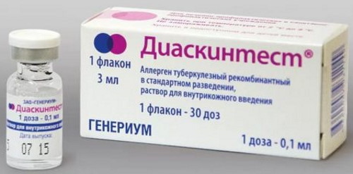 Синяк на месте Диаскинтеста после прививки это норма? Фото