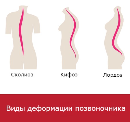 Айкуне гимнастика для позвоночника. Пошаговая инструкция, комплекс упражнений для дома