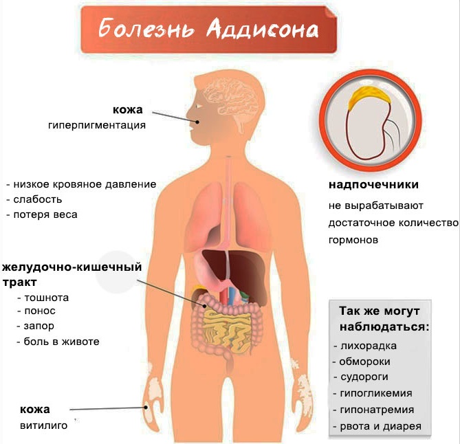 Спиронолактон (Spironolactone). Показания к применению, инструкция, аналоги, цена