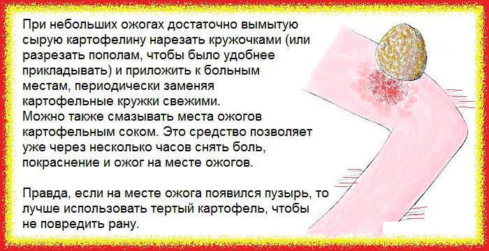 Средства от ожогов кипятком: лекарства, народные рецепты, лечение в домашних условиях