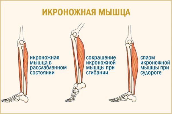 Сводит мышцы по всему телу. Причины и лечение, чего не хватает в организме