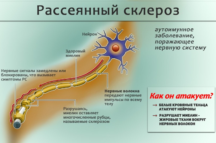 ЭНМГ нижних/верхних конечностей. Что это такое, цена обследования, как делают