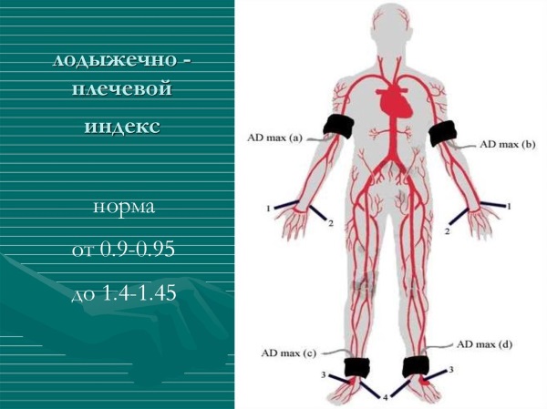 УЗДГ вен нижних конечностей. Что это, подготовка к процедуре, где сделать, цены в Москве