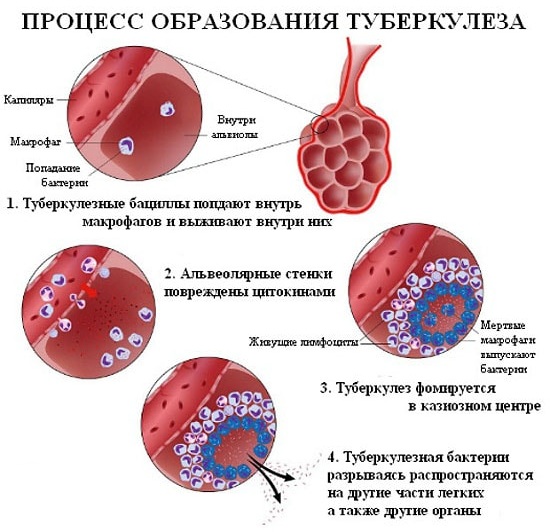 Живая аттенуированная вакцина. Что это такое, что значит, содержит против краснухи, кори, паротита, оспы, гепатита