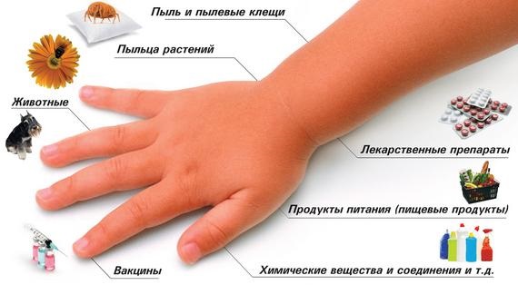 Зодак. Инструкция по применению капель для детей, сколько принимать от аллергии. Цена, отзывы, аналоги