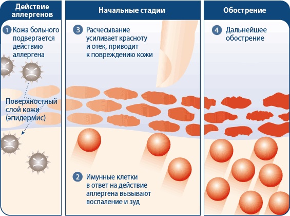 Зодак. Инструкция по применению капель для детей, сколько принимать от аллергии. Цена, отзывы, аналоги