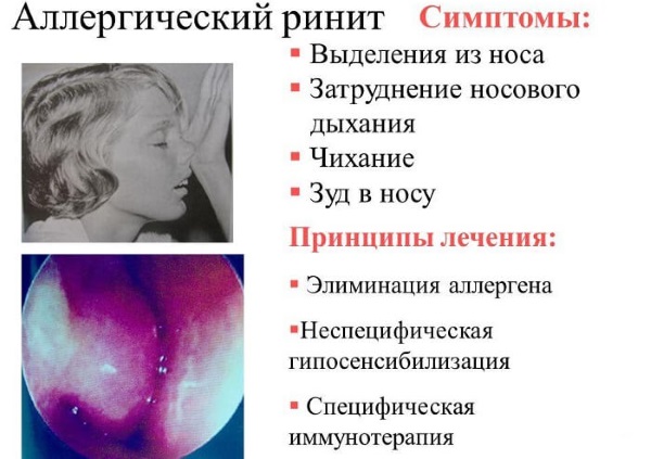 Зодак. Инструкция по применению капель для детей, сколько принимать от аллергии. Цена, отзывы, аналоги