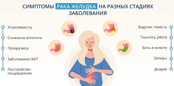Рентгеноскопия пищевода, желудка с барием. Как делается, цена