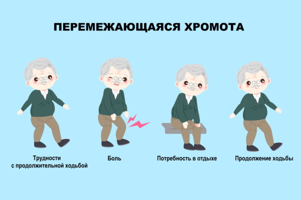 Фиброзная дисплазия бедренной (большеберцовой) кости. Что это, лечение