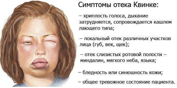 Аджови (Ajovy) от мигрени. Инструкция по применению, цена, отзывы