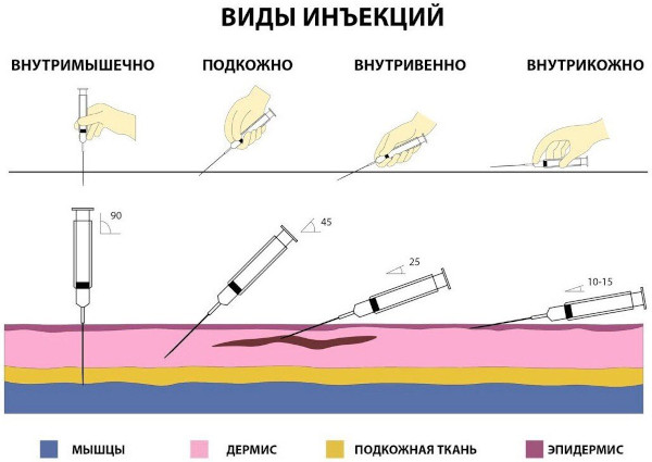 Аджови (Ajovy) от мигрени. Инструкция по применению, цена, отзывы