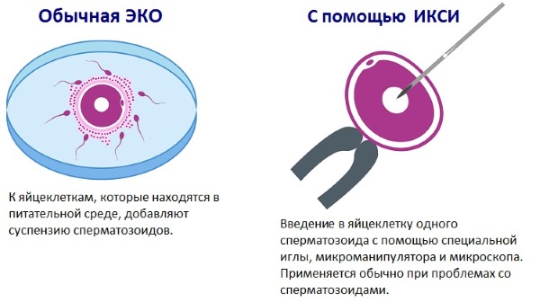 Антимюллеров гормон у женщин. Норма АМГ по возрасту, таблица. Уровень гормона при беременности, для ЭКО, как сдавать анализ, как повысить пониженный показатель