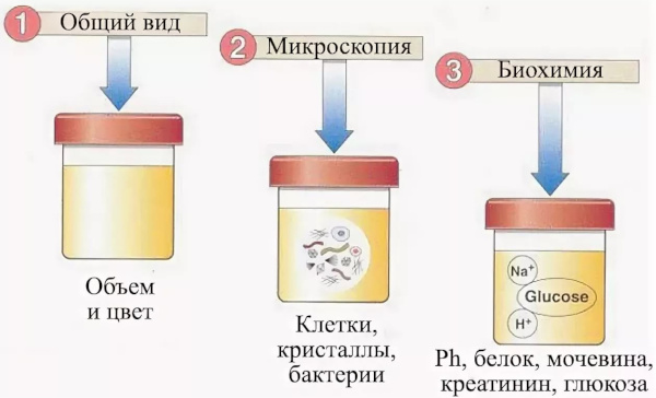 Анализы при анемии у женщин, мужчин, ребенка