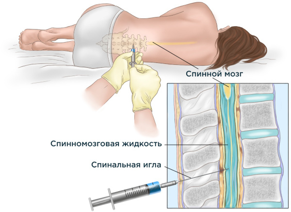 Анализы при анемии у женщин, мужчин, ребенка