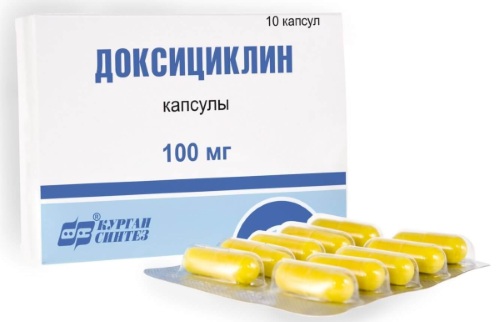 Заболевания мочевыделительной системы у женщин. Симптомы и лечение