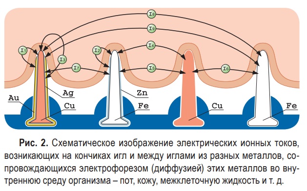 Аппликатор Ляпко для позвоночника. Отзывы, какой лучше