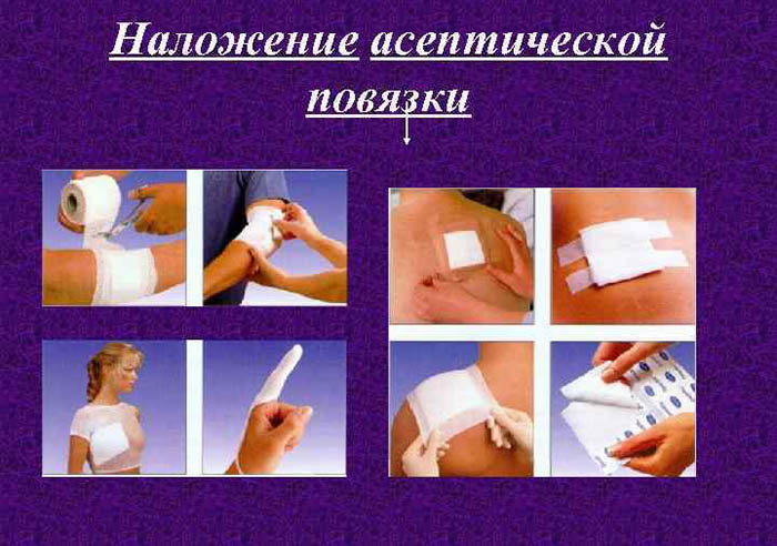 Асептическая повязка. Что это такое, алгоритм наложения на рану