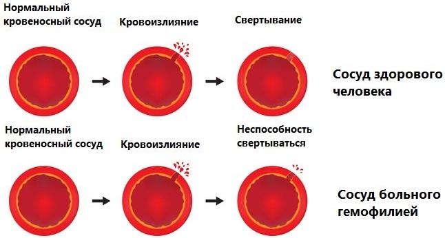 Флавоноиды. Влияние на организм, в каких продуктах содержится, полезные свойства, применение