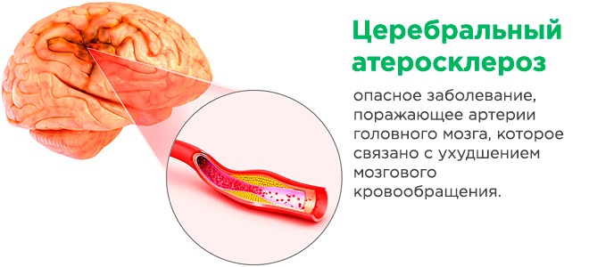 Писк в ушах и голове. Причины, как избавиться