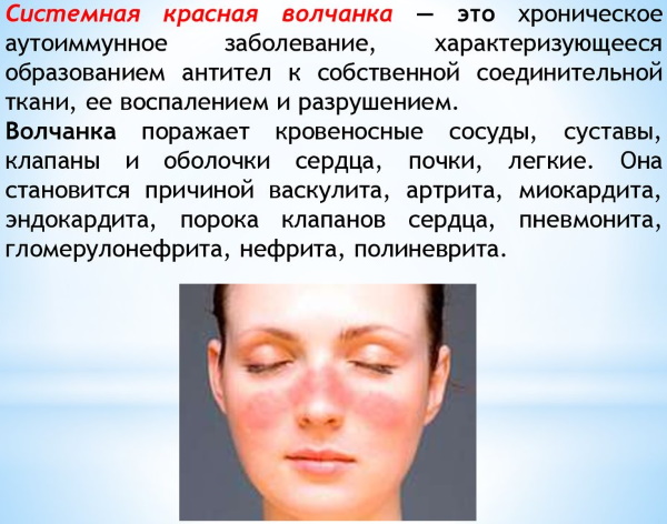 Аутоиммунные заболевания. Список болезней, симптомы и лечение