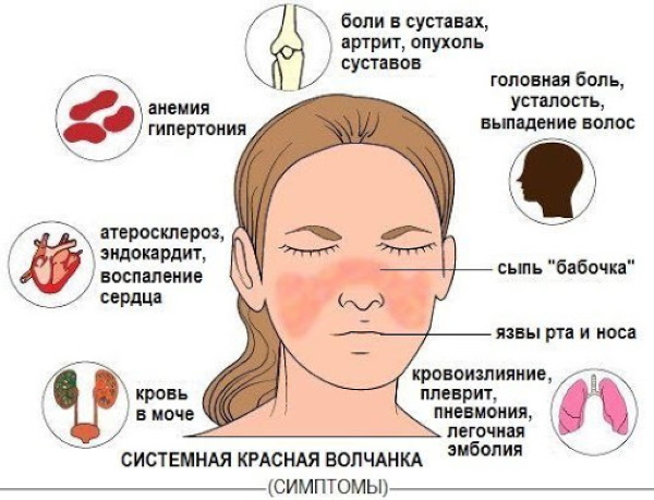 Аутоиммунные заболевания. Список болезней, симптомы и лечение