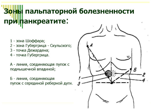 Аутоиммунный панкреатит. Симптомы, клинические рекомендации