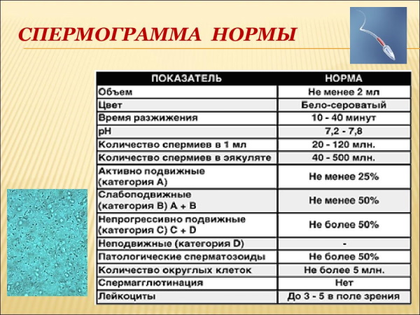 Азооспермия. Что это такое, лечится или нет