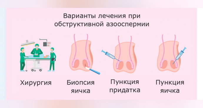 Азооспермия. Что это такое, лечится или нет