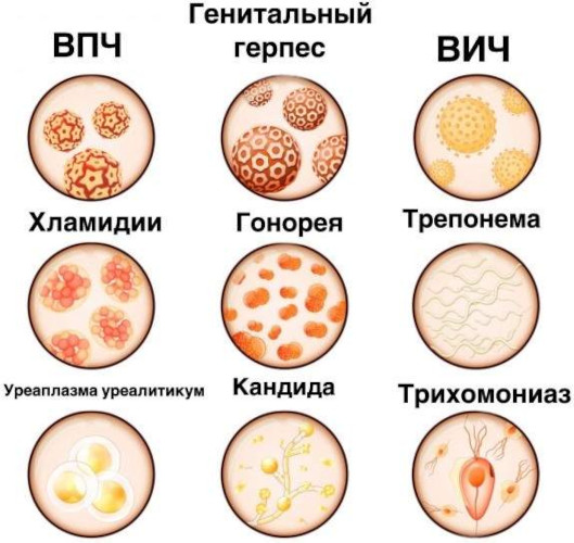Бактериальный хронический простатит. Симптомы, лечение