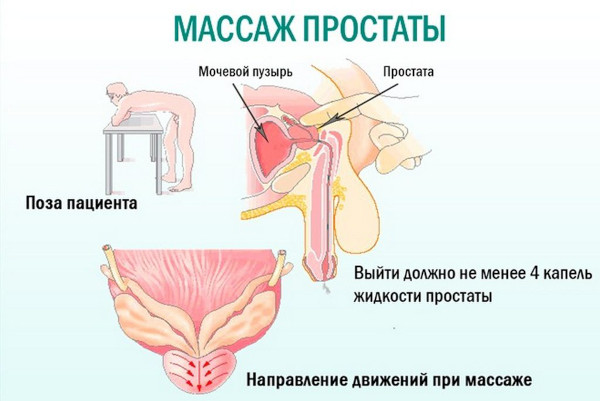Бактериальный хронический простатит. Симптомы, лечение