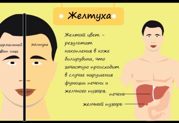 Как проверить печень на заболевания, анализы, анализы, врачи